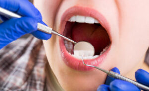 Woman having a dental exam performed by a dentist